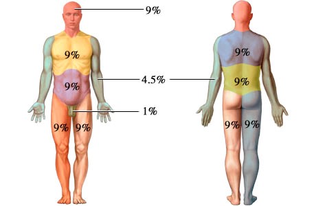 Rule of Nine for Adults:Anterior side of body:Head and neck 9%Upper Thorax 9%Lower Thorax 9%Right Leg 9%Left Leg 9%Right Arm 4.5%Left Arm 4.5%Perineum 1%Poster side of body:Head and neck 9%Upper Thorax 9%Lower Thorax 9%Right Leg 9%Left Leg 9%Right Arm 4.5%Left Arm 4.5%